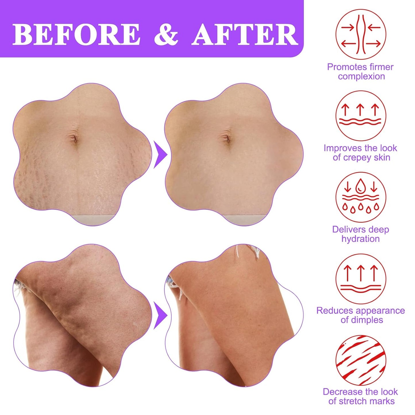 🎁Limited-time offer: Buy two, get one free✨ Kevyxa Tighten & Smooth Belly Firming Cream