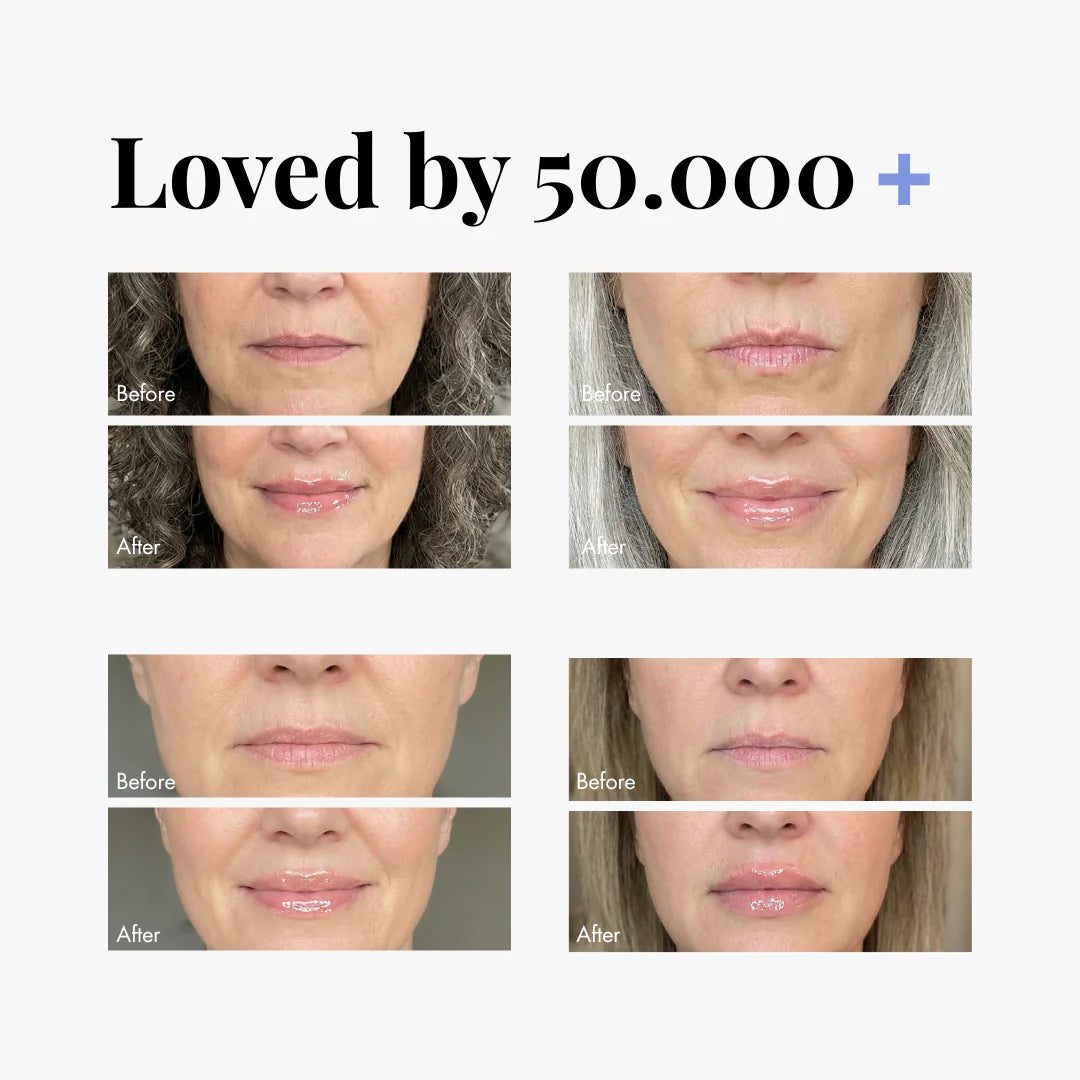 Double Your Order at No Extra Cost-Effortlessly Fuller, Softer Lips💄