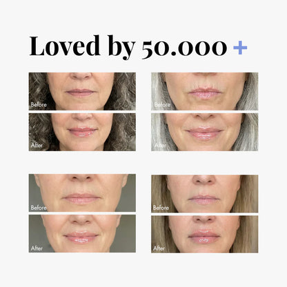 Double Your Order at No Extra Cost-Effortlessly Fuller, Softer Lips💄